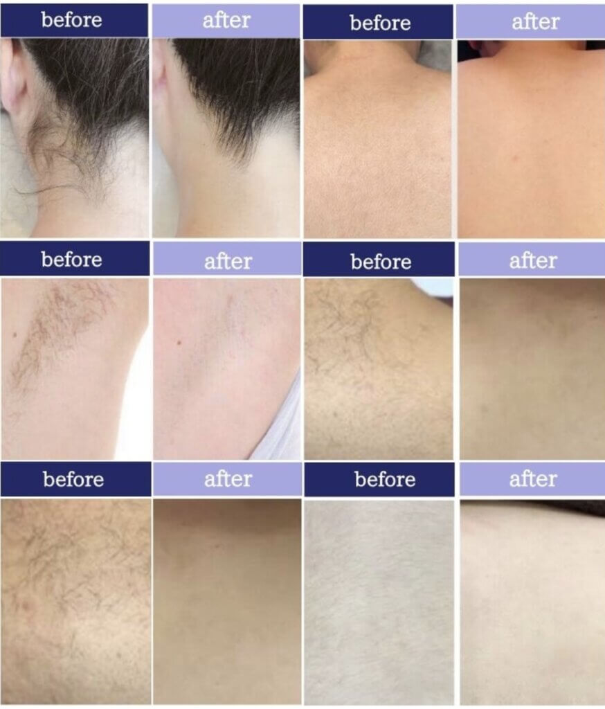 ワンスライド式のビフォーアフター