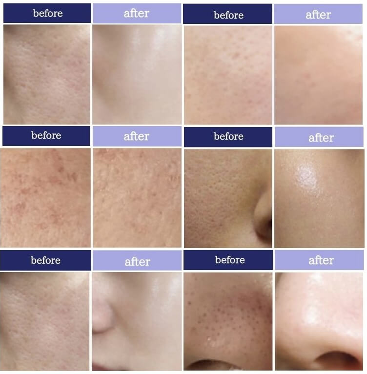 顔のビフォー・アフター