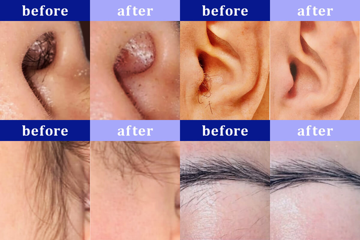 ビフォーアフター