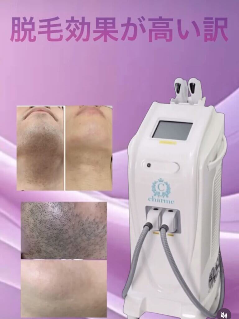 効果が高い脱毛機